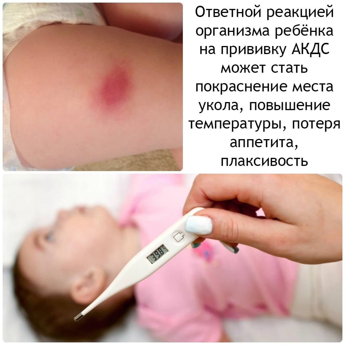 Что делать с шишкой после прививки