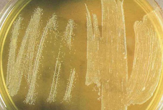 Yersinia pestis Yersinia pestis