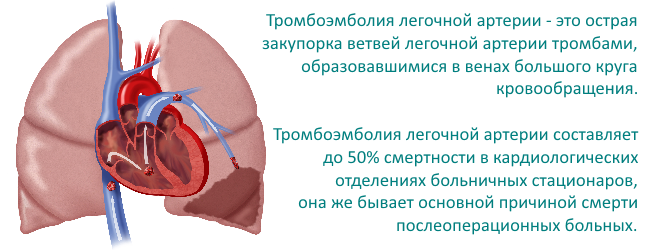 Тромбоэмболия ветвей легочной артерии