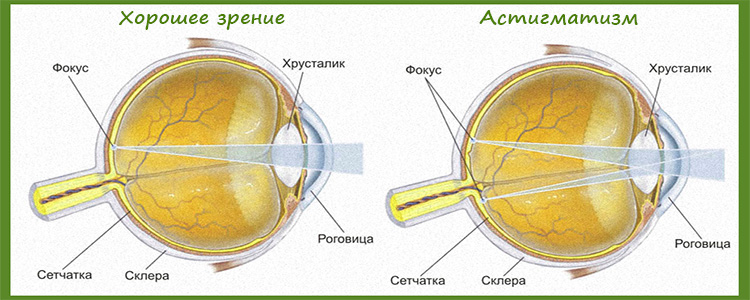 Проверка астигматизма картинка